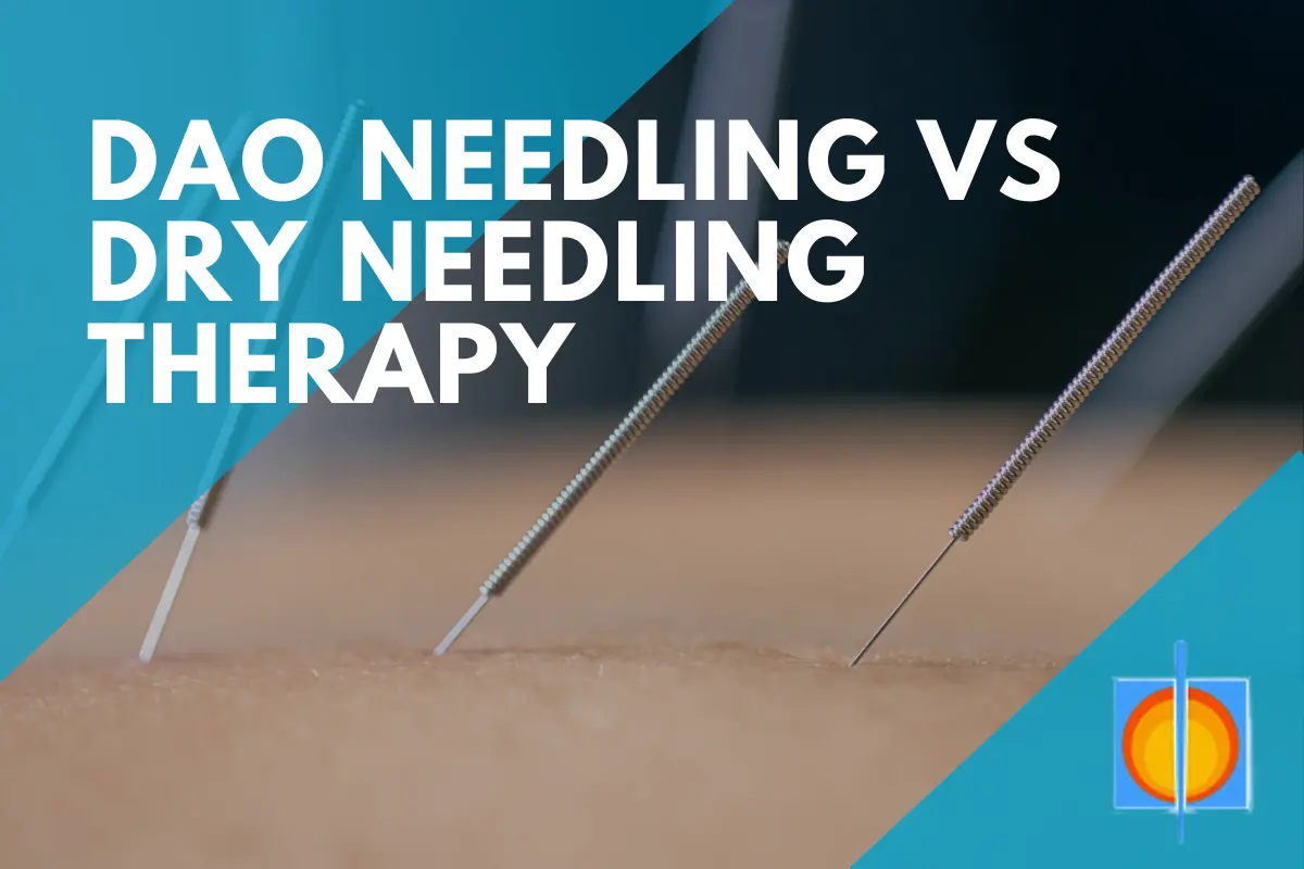 Dry Needling and Dao Needle Therapy