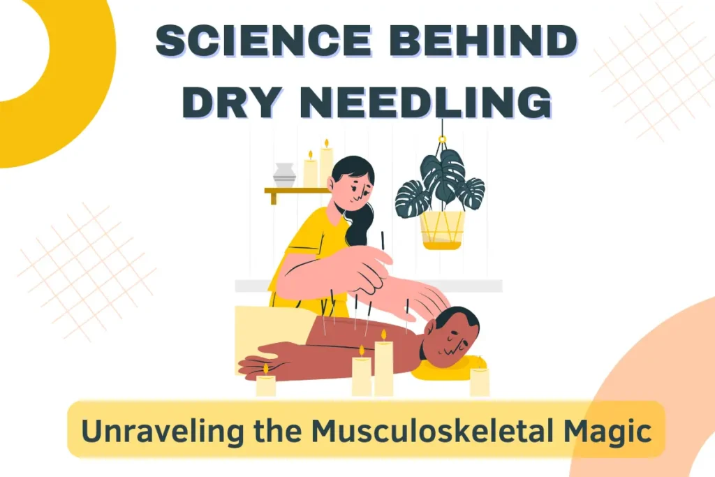 Science Behind Dry Needling